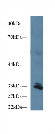 Polyclonal Antibody to Peptidylprolyl Isomerase E (PPIE)