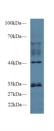 Polyclonal Antibody to Peptidylprolyl Isomerase E (PPIE)