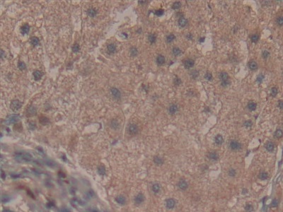 Polyclonal Antibody to Fibromodulin (FMOD)