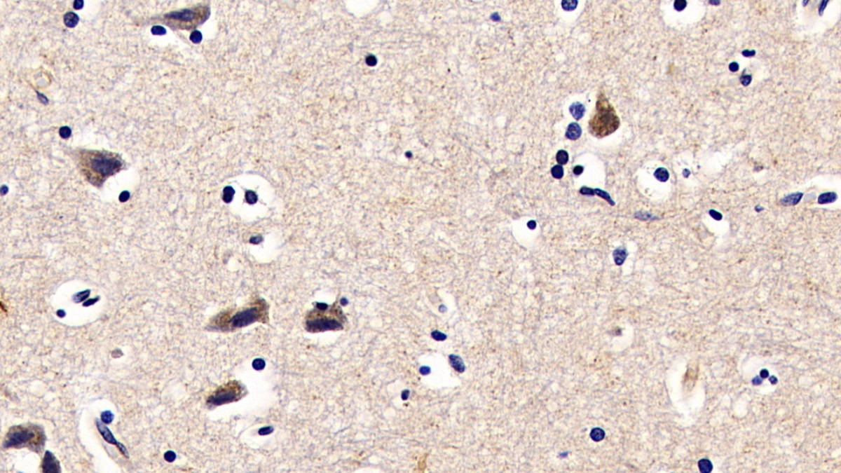 Polyclonal Antibody to Fibromodulin (FMOD)