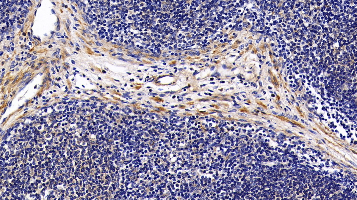 Polyclonal Antibody to Fibromodulin (FMOD)