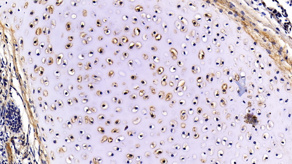 Polyclonal Antibody to Fibromodulin (FMOD)