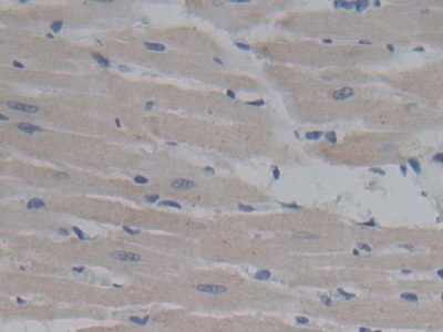 Polyclonal Antibody to Fibromodulin (FMOD)