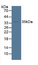 Polyclonal Antibody to Sorbitol Dehydrogenase (SDH)