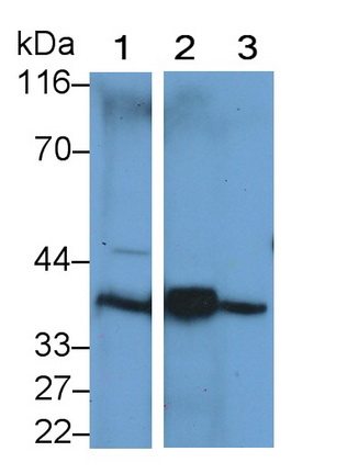 Polyclonal Antibody to Sorbitol Dehydrogenase (SDH)