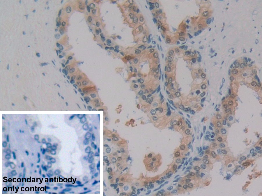 Polyclonal Antibody to Sorbitol Dehydrogenase (SDH)