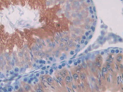 Polyclonal Antibody to Sorbitol Dehydrogenase (SDH)