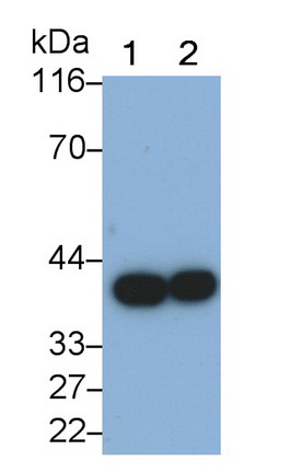 Polyclonal Antibody to Sorbitol Dehydrogenase (SDH)