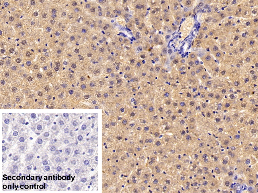 Polyclonal Antibody to Sorbitol Dehydrogenase (SDH)