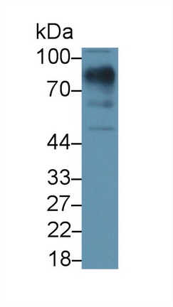 Polyclonal Antibody to Lumican (LUM)