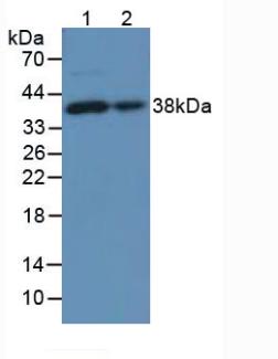 Polyclonal Antibody to Lumican (LUM)