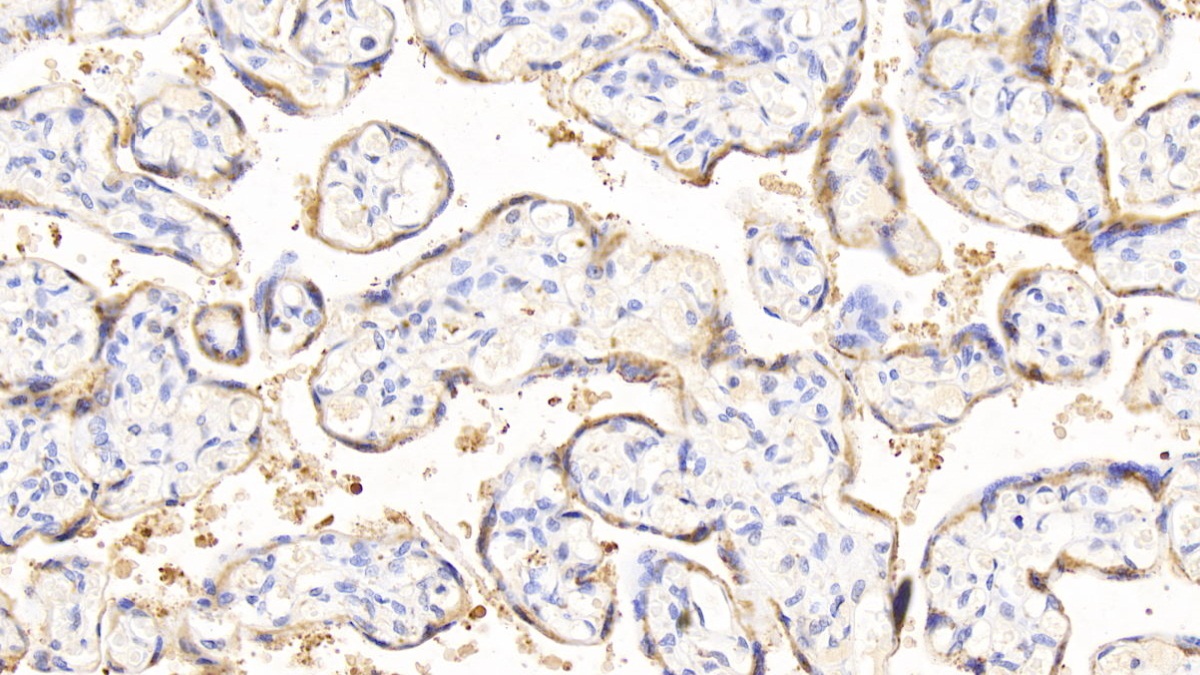 Polyclonal Antibody to Endoplasmic Reticulum Resident Protein 57 (ERp57)