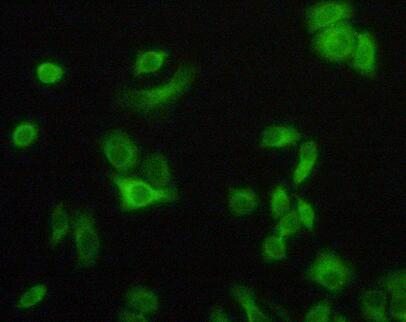 Polyclonal Antibody to Tumor Necrosis Factor Receptor 1 (TNFR1)