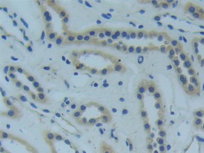 Polyclonal Antibody to Tumor Necrosis Factor Receptor 1 (TNFR1)