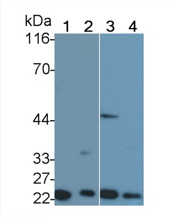 Polyclonal Antibody to Tumor Necrosis Factor Receptor 1 (TNFR1)