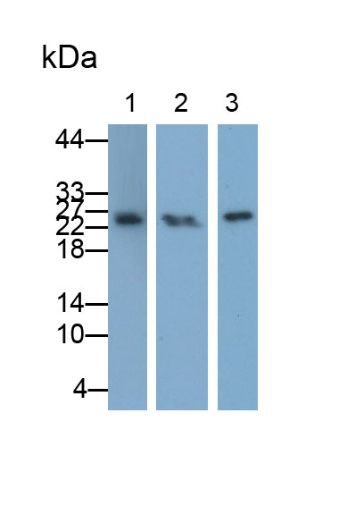 Polyclonal Antibody to Tumor Necrosis Factor Receptor 1 (TNFR1)