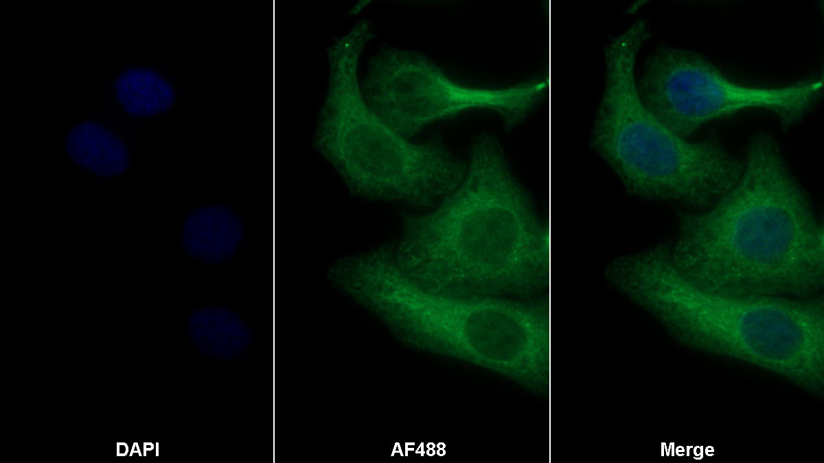 Polyclonal Antibody to Tumor Necrosis Factor Receptor 1 (TNFR1)