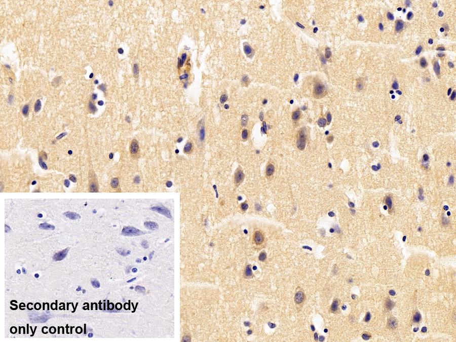 Polyclonal Antibody to Tumor Necrosis Factor Receptor 1 (TNFR1)