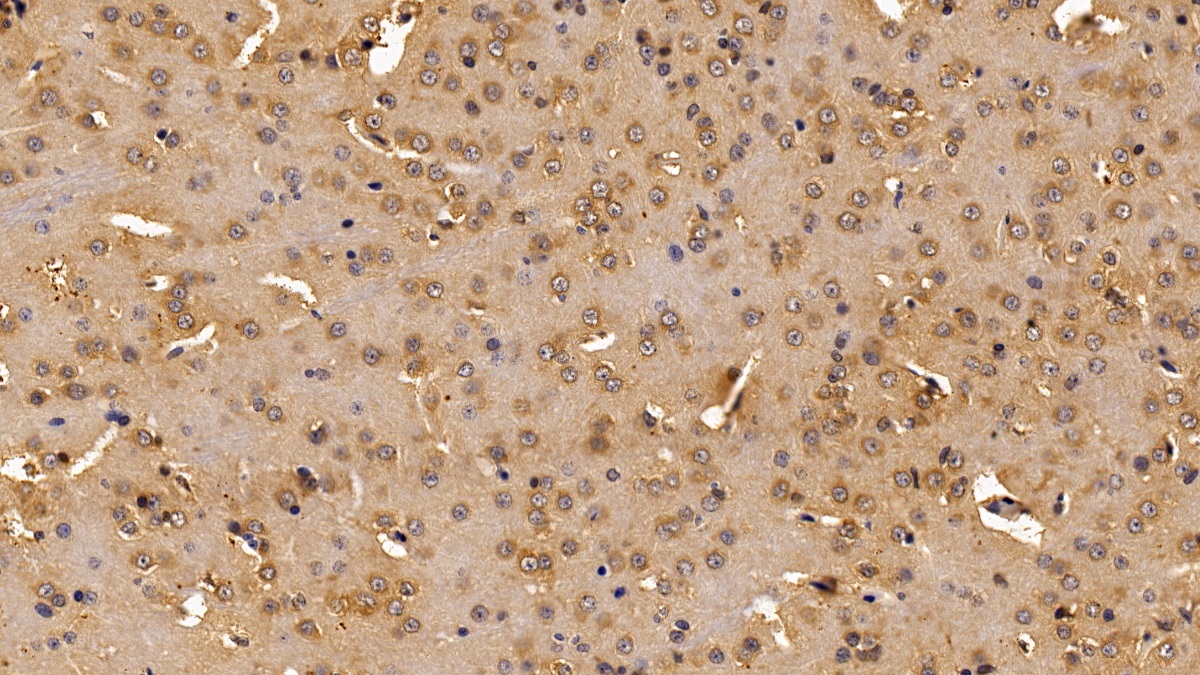 Polyclonal Antibody to Tumor Necrosis Factor Receptor 1 (TNFR1)