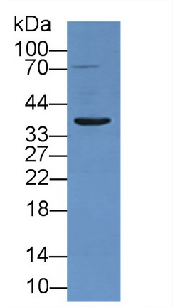 Polyclonal Antibody to Tumor Necrosis Factor Receptor 1 (TNFR1)