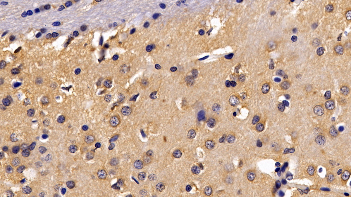 Polyclonal Antibody to Tumor Necrosis Factor Receptor 1 (TNFR1)