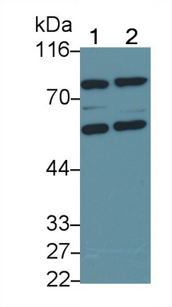 Polyclonal Antibody to Tumor Necrosis Factor Receptor 1 (TNFR1)