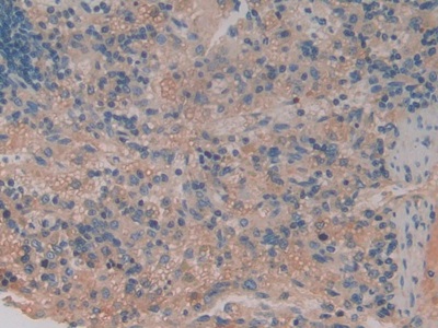 Polyclonal Antibody to Tumor Necrosis Factor Receptor Superfamily, Member 1B (TNFRSF1B)