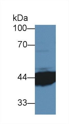 Polyclonal Antibody to Interleukin 3 Receptor Alpha (IL3Ra)