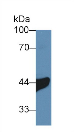 Polyclonal Antibody to Interleukin 3 Receptor Alpha (IL3Ra)