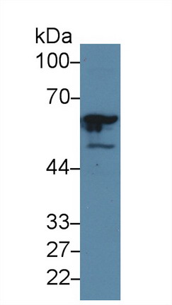 Polyclonal Antibody to General Transcription Factor IIE, Polypeptide 1 (GTF2E1)