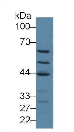 Polyclonal Antibody to General Transcription Factor IIE, Polypeptide 1 (GTF2E1)