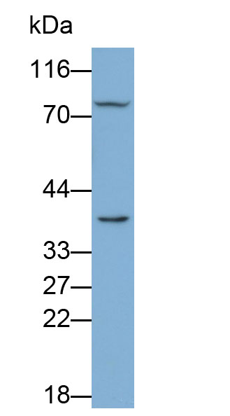 Polyclonal Antibody to Killer Cell Immunoglobulin Like Receptor 2DL1 (KIR2DL1)