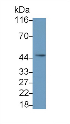 Polyclonal Antibody to Interleukin 5 Receptor Alpha (IL5Ra)