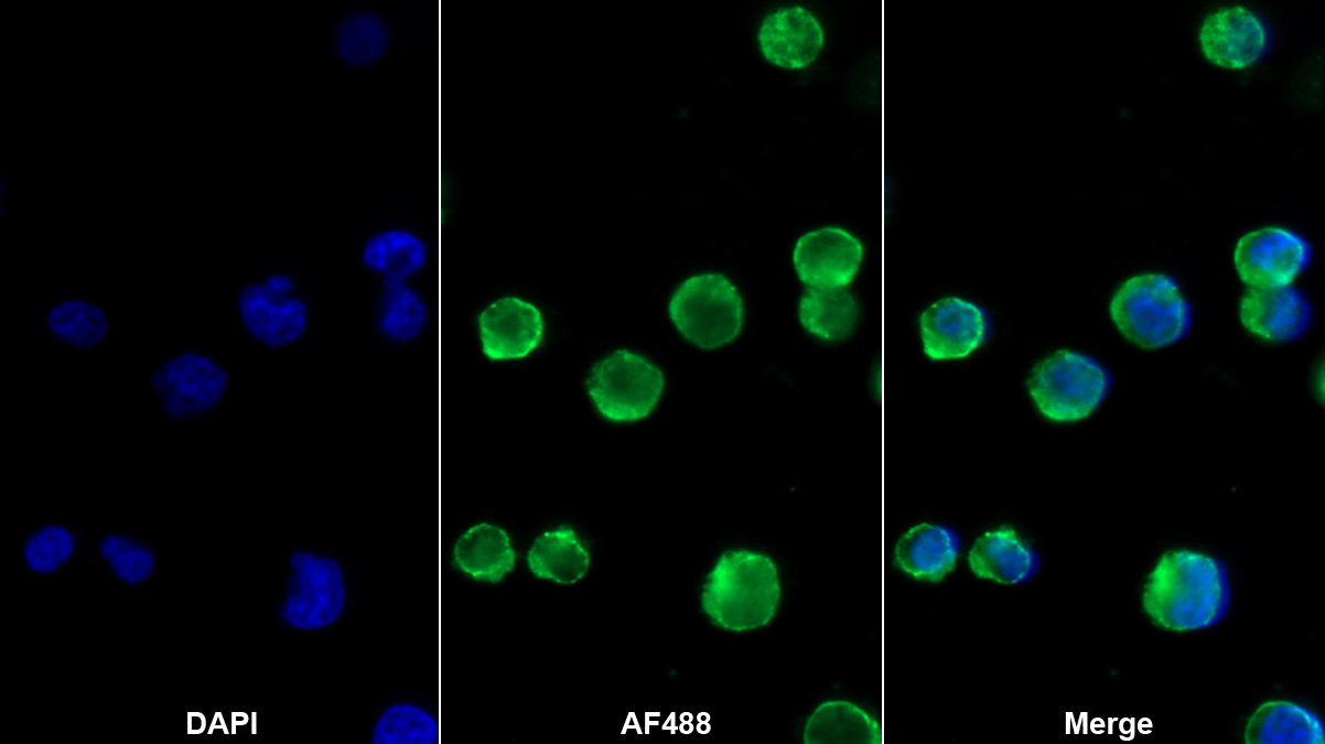 Polyclonal Antibody to Interleukin 2 Receptor Gamma (IL2Rg)