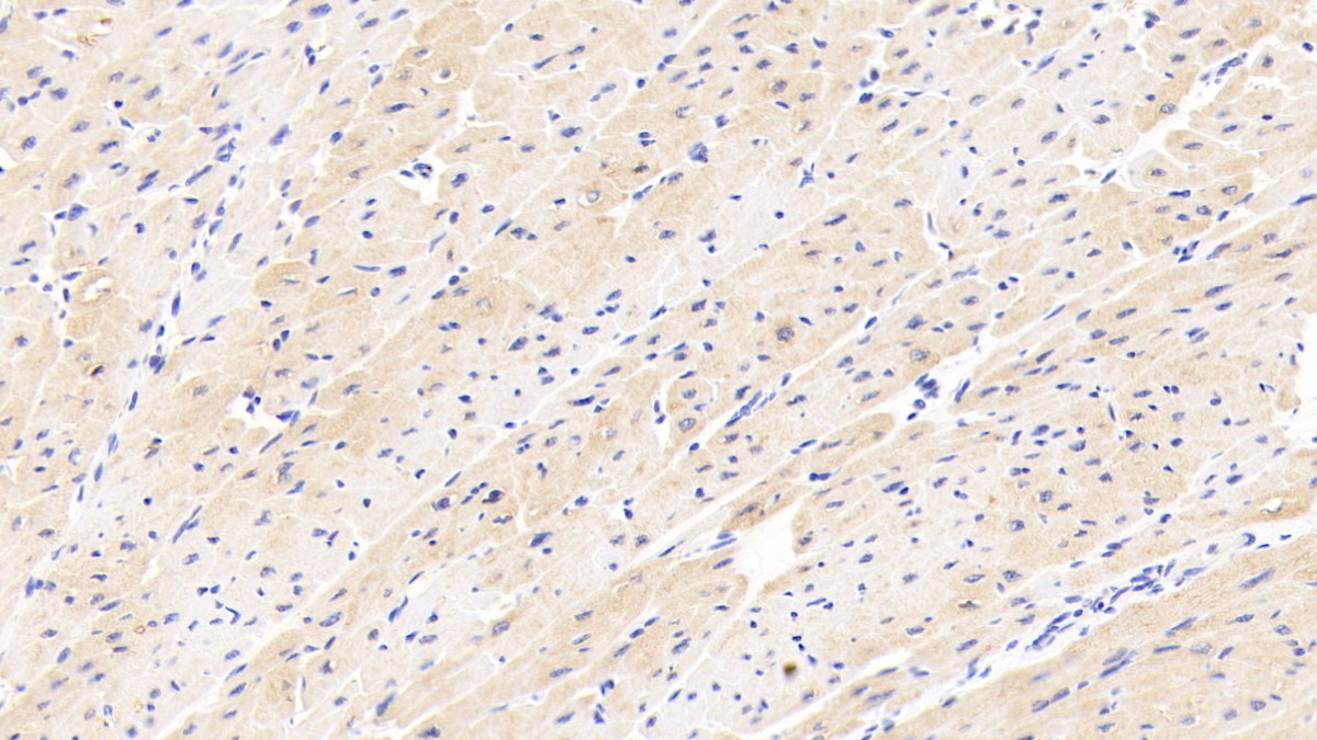 Polyclonal Antibody to Cholinergic Receptor, Nicotinic, Beta 2 (CHRNb2)