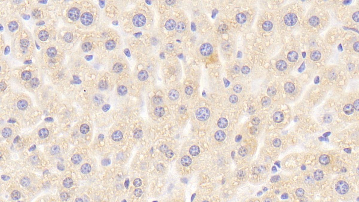 Polyclonal Antibody to Interleukin 1 Receptor Associated Kinase 2 (IRAK2)