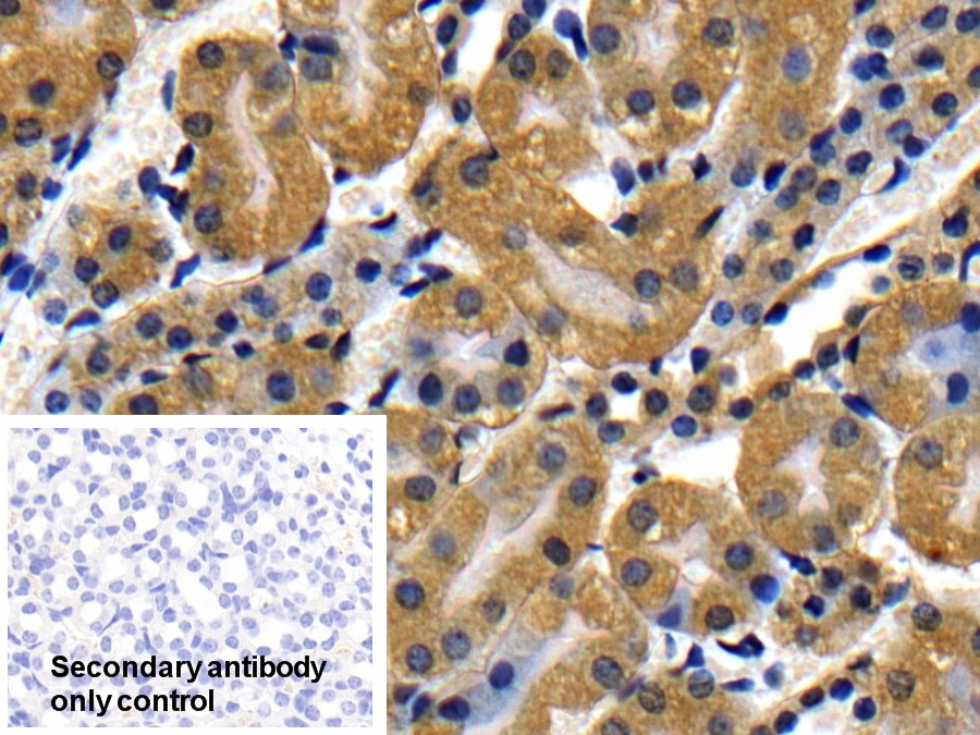 Polyclonal Antibody to Interleukin 1 Receptor Associated Kinase 2 (IRAK2)