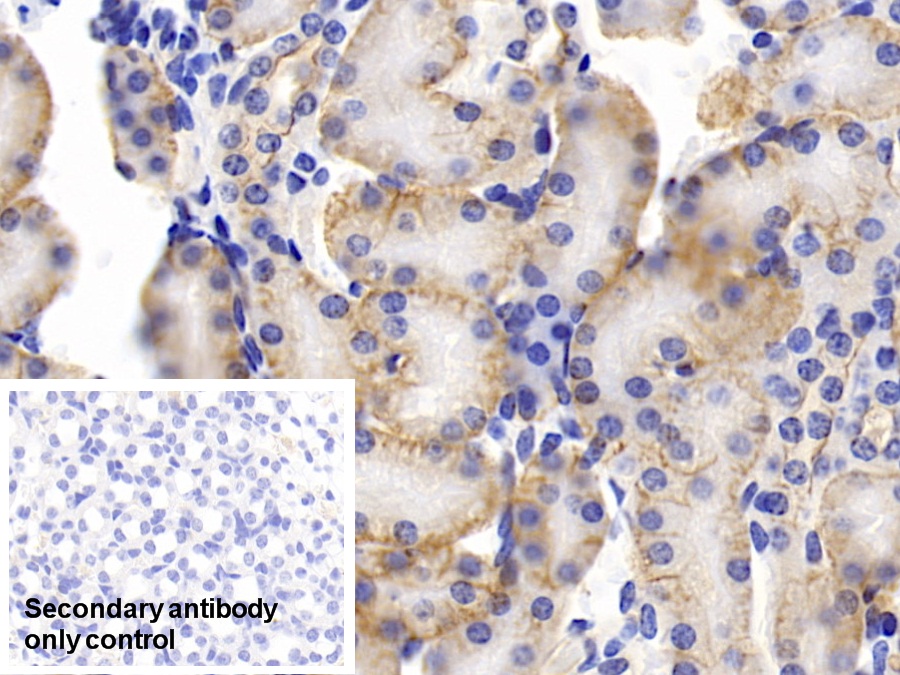 Polyclonal Antibody to Prominin 1 (PROM1)