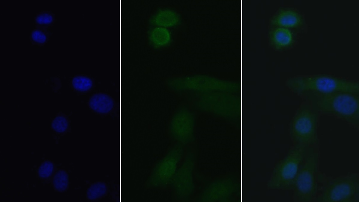 Polyclonal Antibody to Interleukin 1 Receptor Associated Kinase 3 (IRAK3)