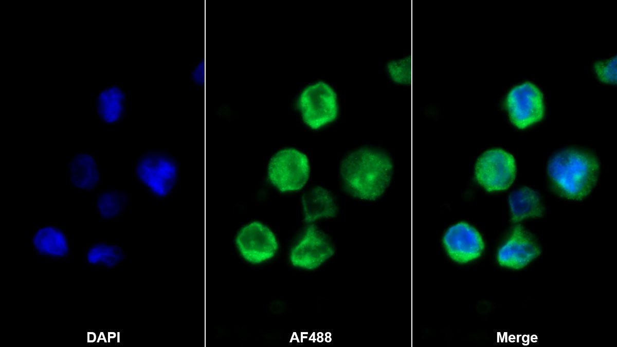 Polyclonal Antibody to Chemokine C-X3-C-Motif Receptor 1 (CX3CR1)