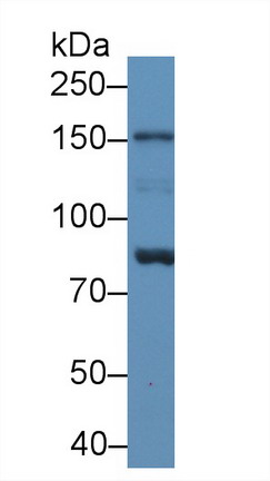 Polyclonal Antibody to Neuronal Apoptosis Inhibitory Protein (NAIP)