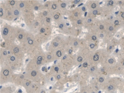 Polyclonal Antibody to Neuronal Apoptosis Inhibitory Protein (NAIP)