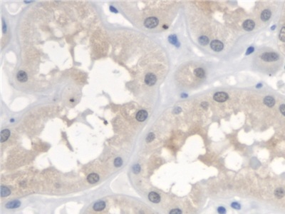 Polyclonal Antibody to Neuronal Apoptosis Inhibitory Protein (NAIP)