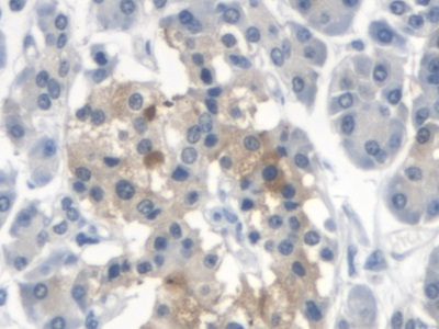 Polyclonal Antibody to Neuronal Apoptosis Inhibitory Protein (NAIP)