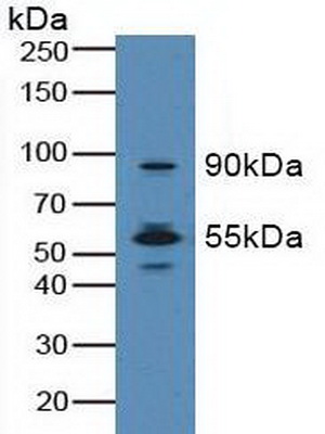 Polyclonal Antibody to Macrophage Stimulating 1 Receptor (MST1R)