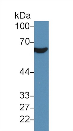 Polyclonal Antibody to Cluster Of Differentiation 36 (CD36)