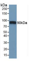 Polyclonal Antibody to Cluster Of Differentiation 36 (CD36)