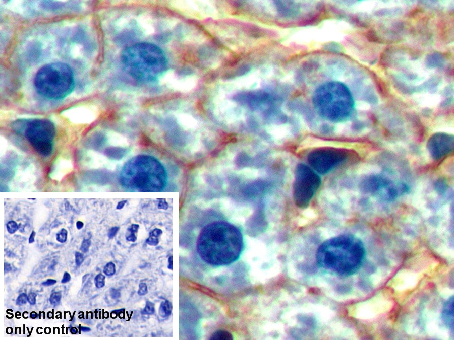 Polyclonal Antibody to Cluster Of Differentiation 36 (CD36)