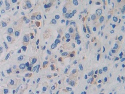 Polyclonal Antibody to Probable ATP-dependent RNA Helicase DDX58 (DDX58)