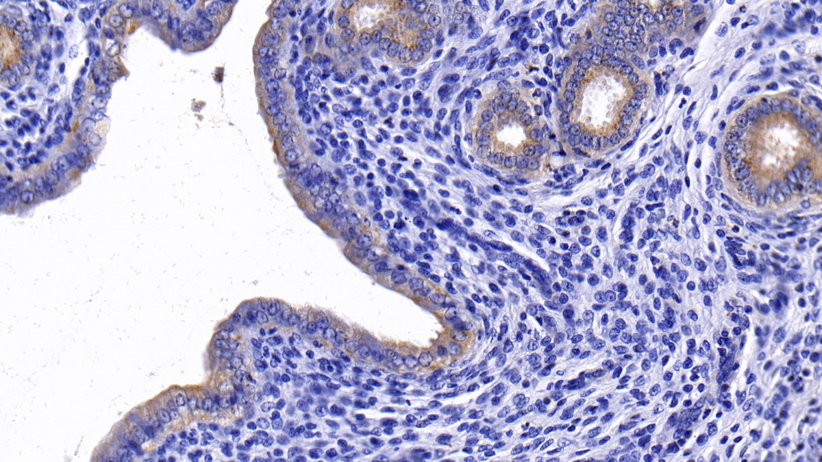 Polyclonal Antibody to Probable ATP-dependent RNA Helicase DDX58 (DDX58)